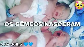 OS GÊMEOS NASCERAM DE 35 SEMANAS..