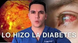 Creyó que perdía la vista por la edad pero era la diabetes | Dr. William Guerrero