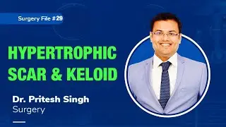 Topic | HYPERTROPHIC SCAR & KELOID I Dr. Pritesh SIngh | Surgery