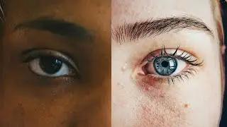 The 5 Different Types of Eye Colors In the World