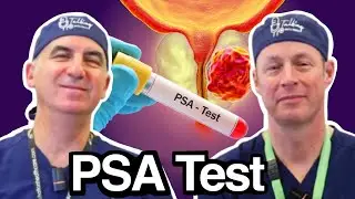 What Is the PSA Test and Why Should You Get One?