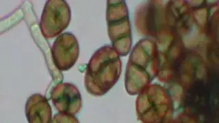Health Effects of Mold Exposure
