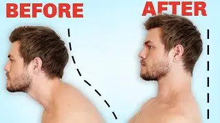 How to Fix Forward Head Posture (FOREVER)