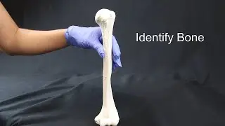 Quiz on Appendicular Skeleton Part I (Upper Limbs)