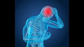 Concussions: Lessening the Blow