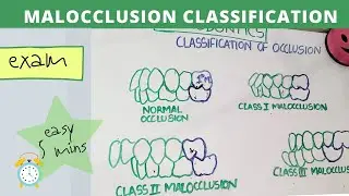 malocclusion of teeth I orthodontics lecture
