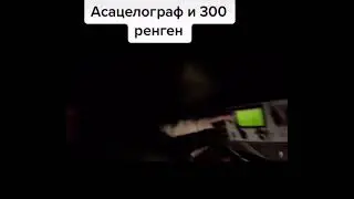 Асацелограф и 300 ренген