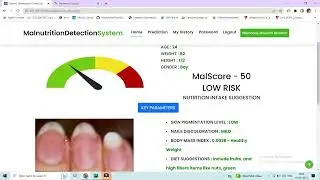 Malnutrition Detection System Project using Deep Learning Python Django