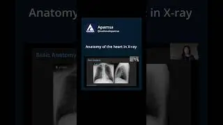 Anatomy of heart, x-ray imaging