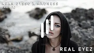 KEAN DYSSO X MADNESS - Real Eyez (Remix) [Bass Boosted]