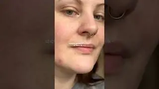 Real skin texture for the win! 