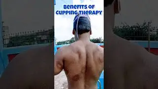 Spotted Circles on Swimmer's Body, Secret for Faster Recovery🔥 #swimmingtips #learnswimming #cupping