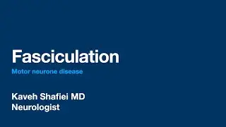 Fasciculation in Motor Neuron Disease