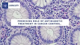 Promising Role of Antidiabetic Treatment in Cancer Control 🔬