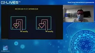 Heart lung interactions in pneumonia