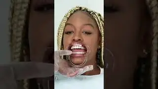 www.myteethwhiteningstore.com