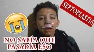 Mí DÍA A DÍA con la SEPTORRINOPLASTÍA 