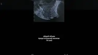 #узи #армдиассистент #дгпж