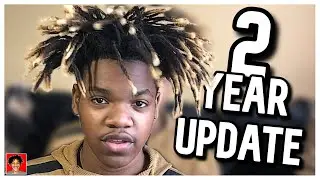 2 Year Dreadlock Update | Dreadlocks