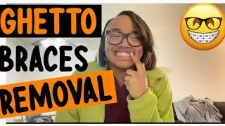 CATCH UP WITH ME VLOG| I GOT MY BRACES REMOVED!!! | The Life Of Bry