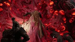 Забытое поле в дальнем лесу:)►Remnant 2 #11