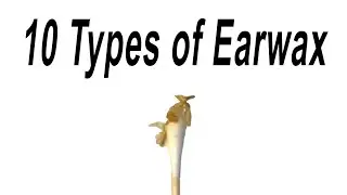 10 Types of Earwax