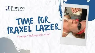 It's time for a Fraxel Laser Treatment