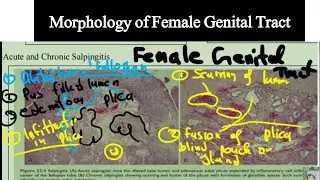 Morphology of Female Genital tract-Special Pathology