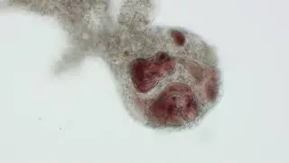 2021 Amoeba captures multiple prey