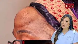 Shoshana's Forehead Secret! | Dr Pimple Popper S3 E5 | TLC India