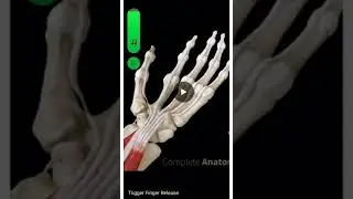 TRIGGER FINGER SURGERY VS MASSAGE #triggerfinger #surgeryrecovery #handmassage