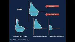 Respiratory Disorders