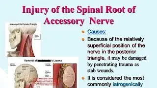 Accessory Nerve Injury/Palsy, Diagnosis , causes and treatment