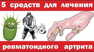 5 средств для лечения РЕВМАТОИДНОГО АРТРИТА.