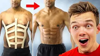 This Man Tried The $10,000 Surgery To Get Abs