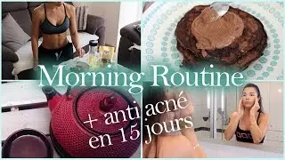 MORNING ROUTINE ANTI ACNE !!!