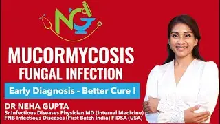 Mucormycosis I Fungus I Risk I Diagnosis I Treatment  #infectiousdiseases#collabration #ngswasatha