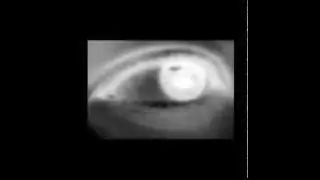 Draconian Method  -  viral infektion