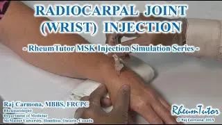 Wrist (Radiocarpal Joint) Injection