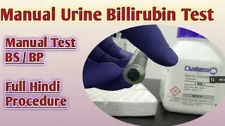 urine bilirubin test | bile pigment test in urine | urine bilirubin manual test procedure