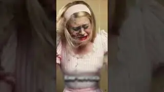 Необычный прыщ 😳😎🔥 