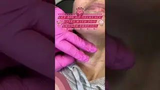 Get Rid of Necklace Lines with PDO Smooth Threads