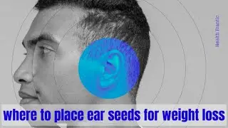 Where to place ear seeds for weight loss