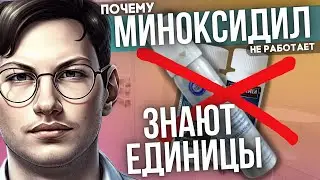 МИНОКСИДИЛ перестал работать |  СИНХРОНИЗАЦИЯ | Толерантность к миноксидилу
