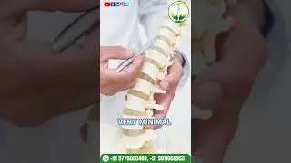 Keyhole surgery for disc problems