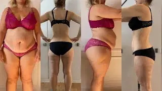 Perdre 50 kg de graisse : Témoignage hyperphagie