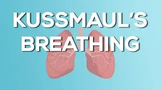 Kussmaul's Breathing - Causes, Demonstration, Treatment