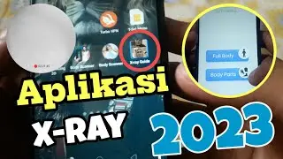 Aplikasi X-ray penembus objek terbaruh 2023