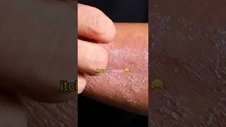 ❌STOP ❌ MAKING THIS SKINCARE MISTAKE!