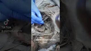 El ligamento redondo o terete del útero